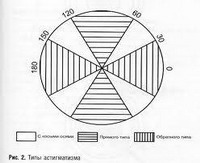 как подобрать очки и контактные линзы при астигматизме?