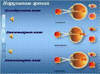 духовные причины возникновения астсигматизма