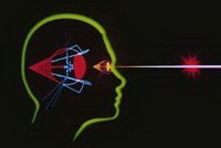 что такое лазерная коррекция зрения, или это манящее слово «лазер»