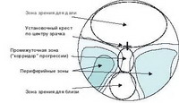 эволюция дизайна прогрессивных очковых линз