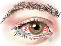глаза и инфекция